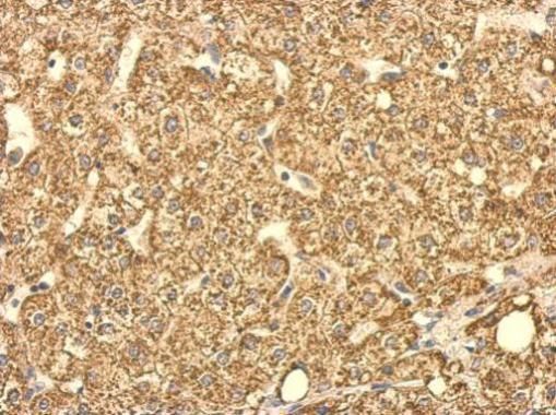 SUCLG2 Rabbit Polyclonal Antibody