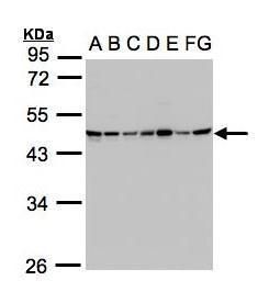 SUCLG2 Rabbit Polyclonal Antibody
