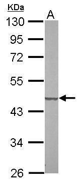 SUCLG2 Rabbit Polyclonal Antibody