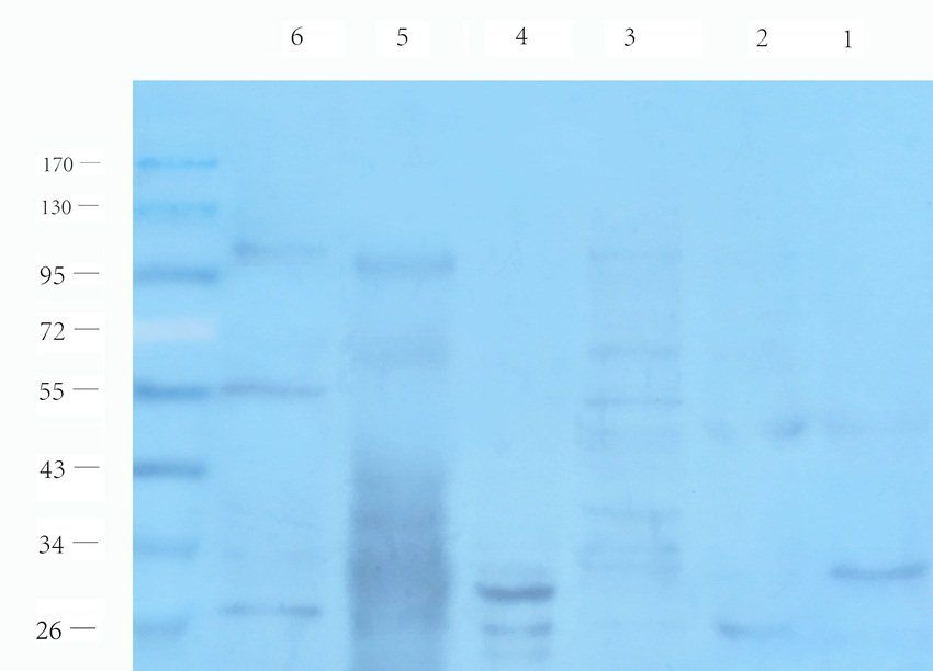 SULF1 Rabbit Polyclonal Antibody