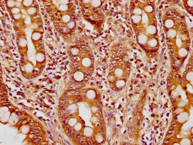 SULT1A2 Antibody