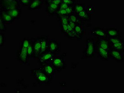 SUMO3 Antibody