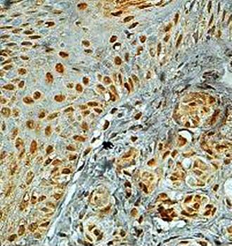 SUMO4 Rabbit Polyclonal Antibody