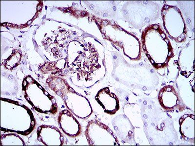 SYCP3 Antibody