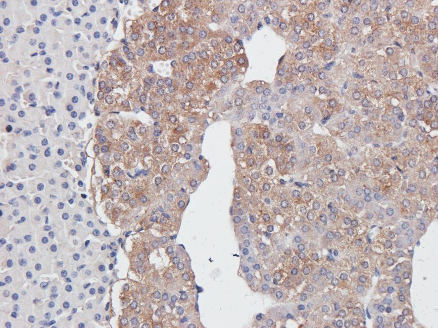 SYP Rabbit Polyclonal Antibody