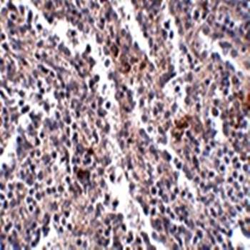 SYPL2 Antibody