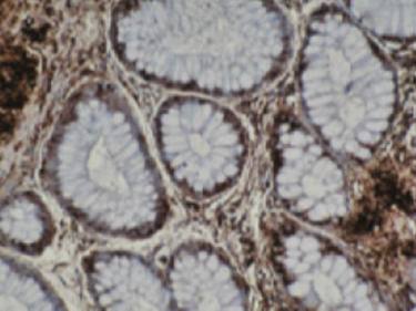 Mouse anti Human T-Complex Protein 1 Antibody, subunit