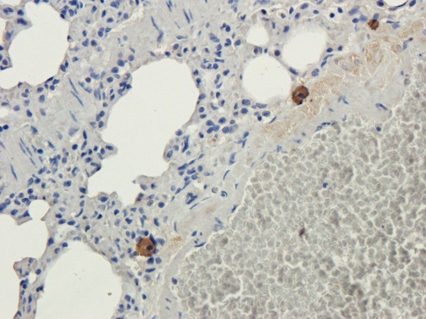 TAL1 Rabbit Polyclonal Antibody
