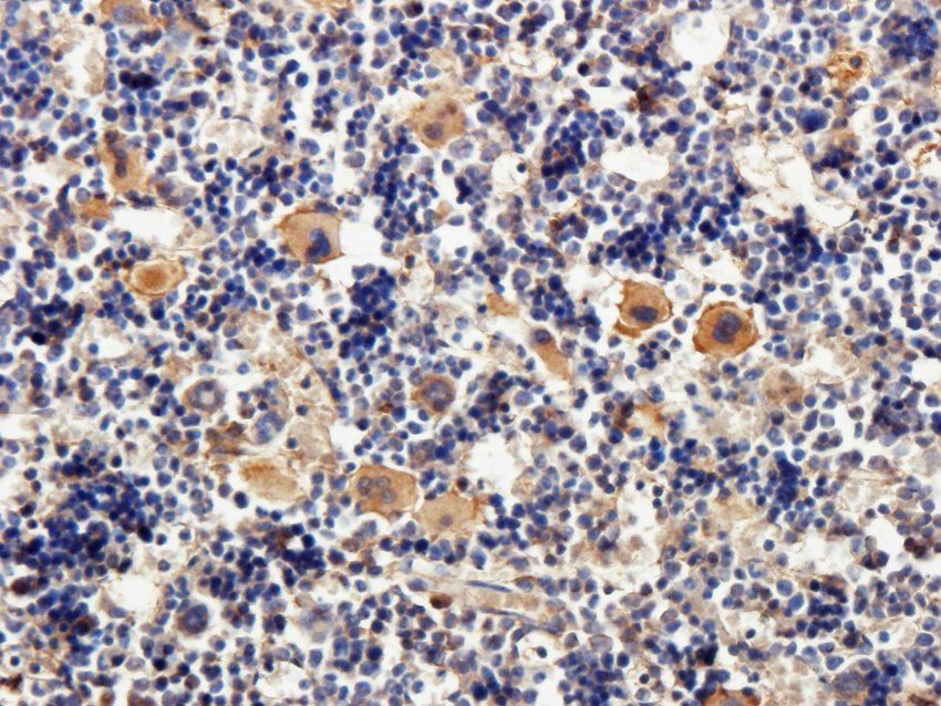 TAL1 Rabbit Polyclonal Antibody