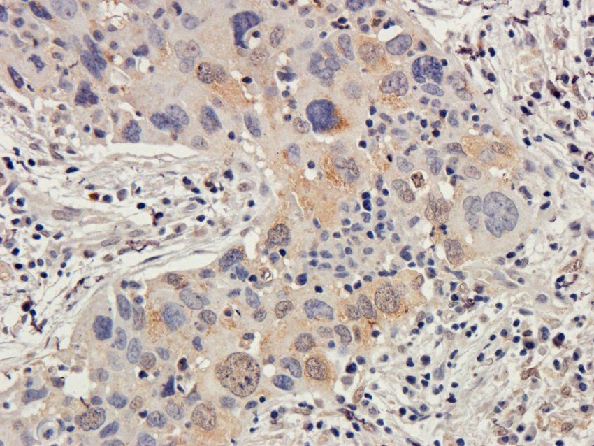 TAL1 Rabbit Polyclonal Antibody