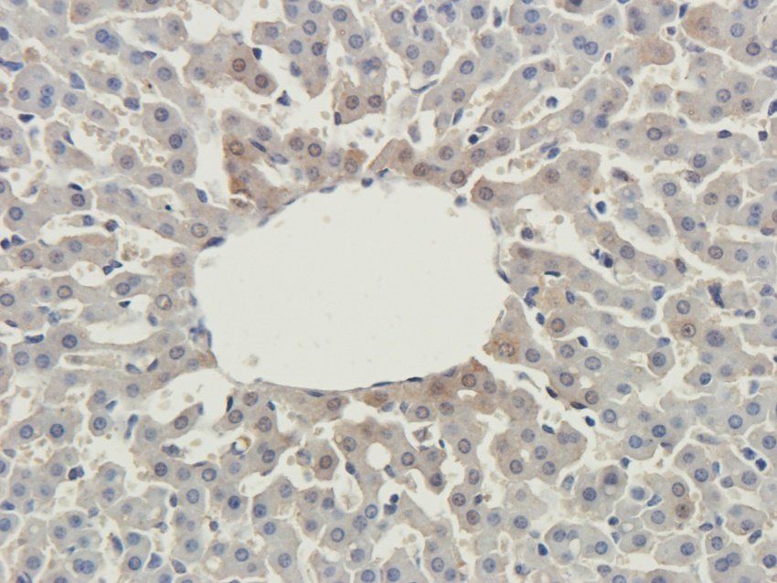TAL1 Rabbit Polyclonal Antibody
