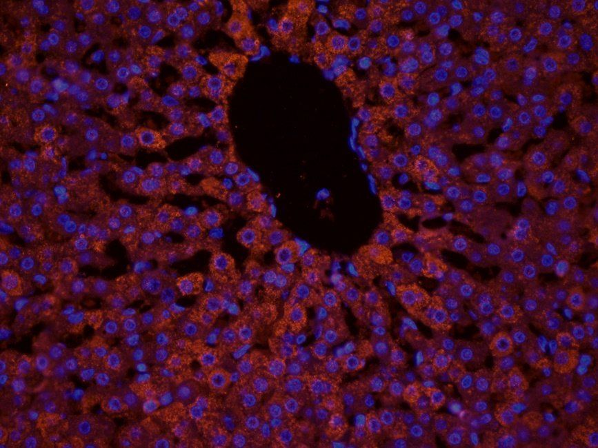 TAL1 Rabbit Polyclonal Antibody