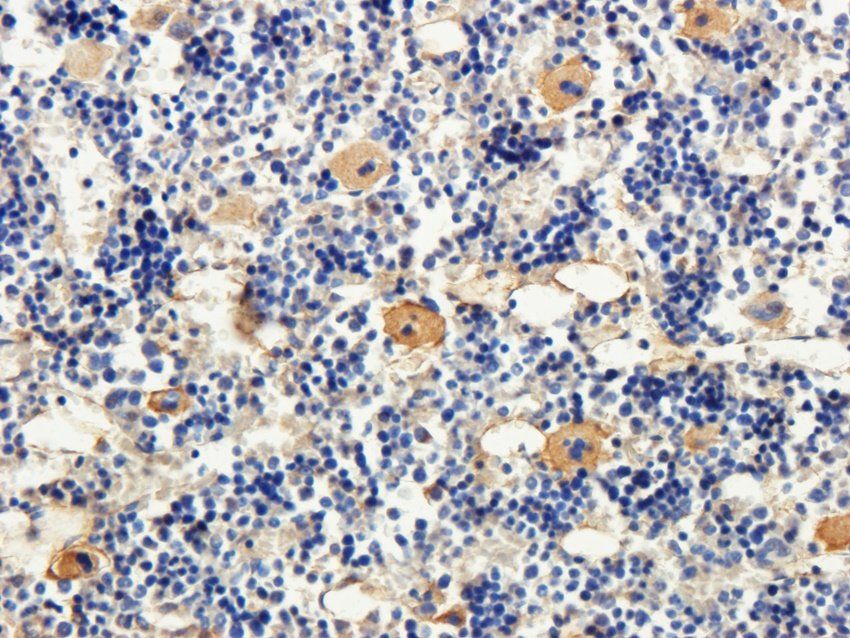 TAL1 Rabbit Polyclonal Antibody