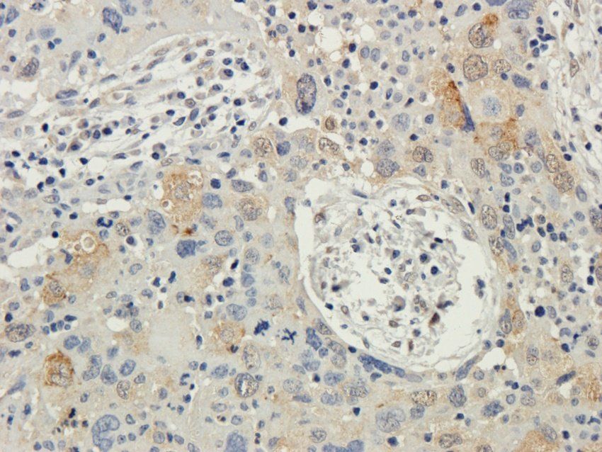 TAL1 Rabbit Polyclonal Antibody