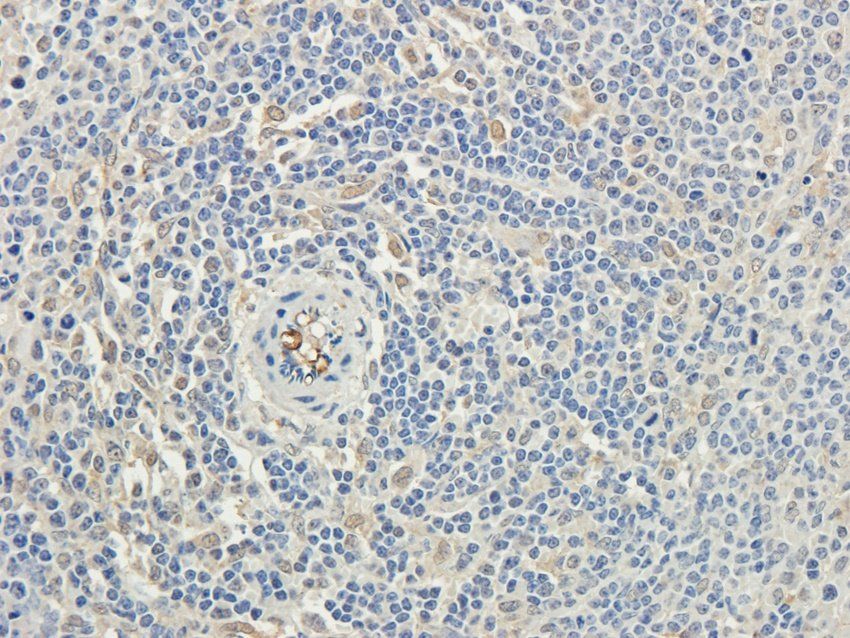 TAL1 Rabbit Polyclonal Antibody