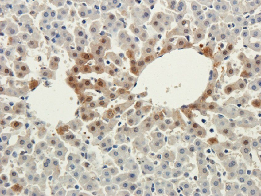 TAL1 Rabbit Polyclonal Antibody