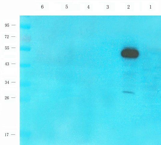 TAL1 Rabbit Polyclonal Antibody