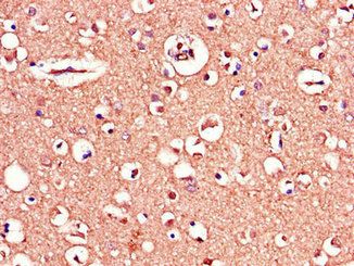 MAPT Antibody