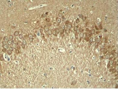Tau(Phospho-Thr181) Antibody