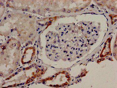 TBC1D4 Antibody