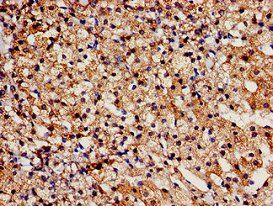 TBC1D4 Antibody