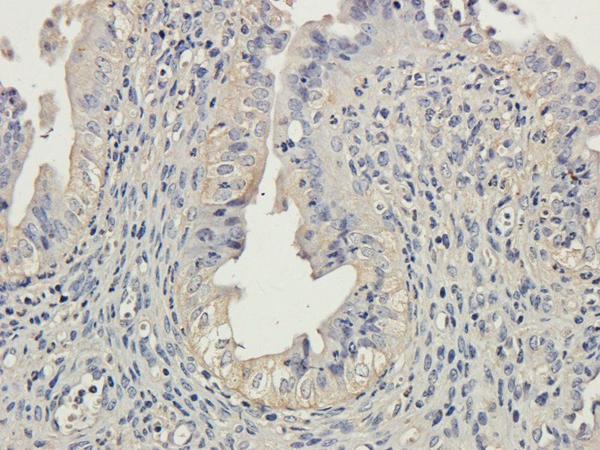 TBX1 Rabbit Polyclonal Antibody