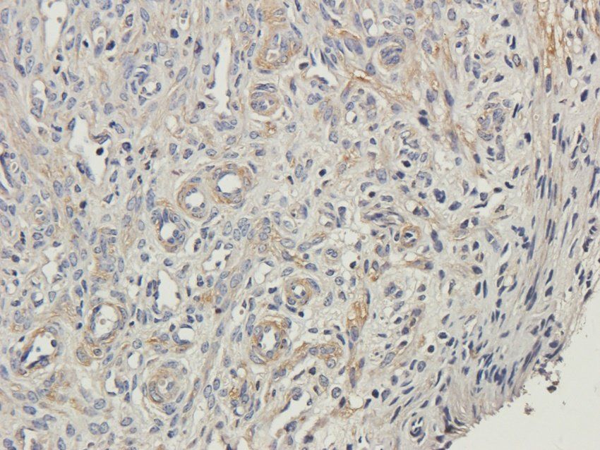 TBX1 Rabbit Polyclonal Antibody