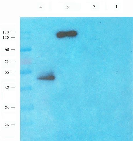 TBX1 Rabbit Polyclonal Antibody