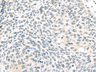 ELOC Antibody