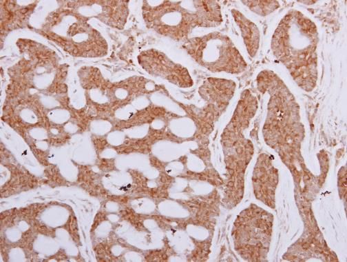 TCP1 epsilon Rabbit Polyclonal Antibody