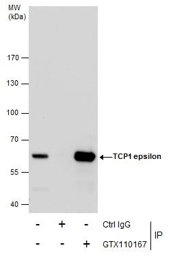 TCP1 epsilon Rabbit Polyclonal Antibody