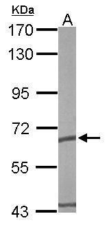 TCP1 epsilon Rabbit Polyclonal Antibody