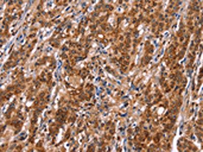 TDP2 Antibody