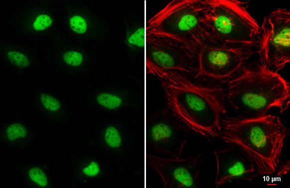 TEAD4 Rabbit Polyclonal Antibody