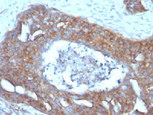 TFF1 Antibody