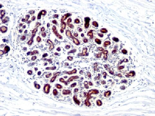 TFF1 Antibody