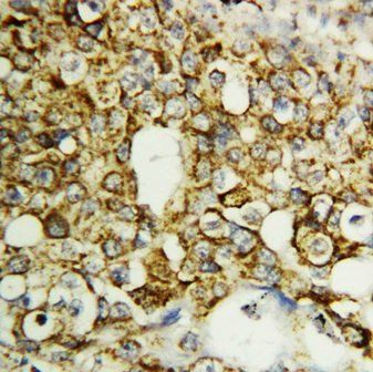 TFPI2 Rabbit Polyclonal Antibody