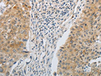 TGFB1 Antibody