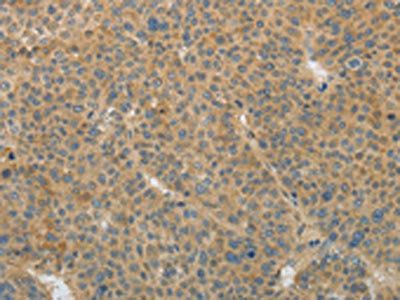 TGFB1 Antibody