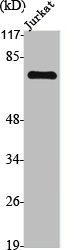 TGFBR2 Antibody
