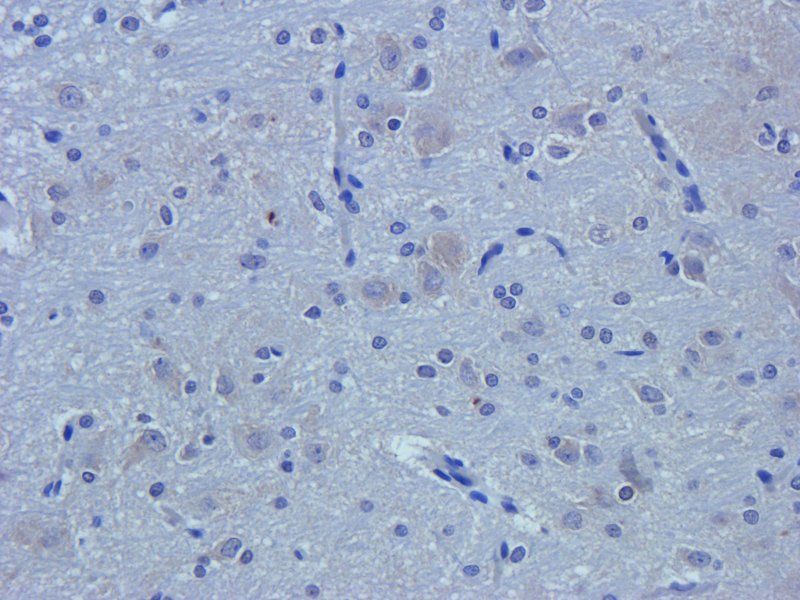 TGF beta Receptor 2 Rabbit Polyclonal Antibody