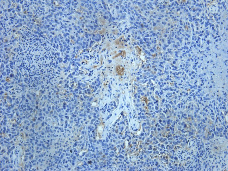 TGF beta Receptor 2 Rabbit Polyclonal Antibody
