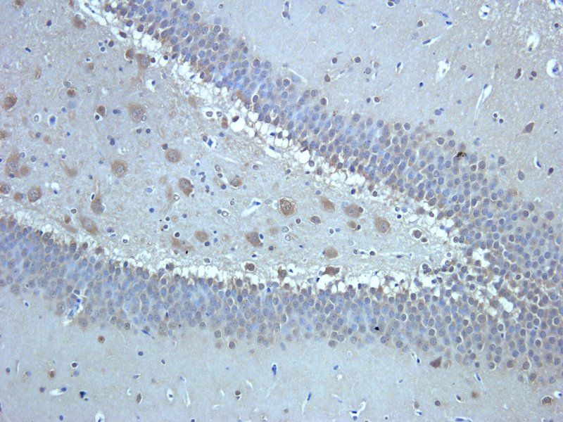TGF beta Receptor 2 Rabbit Polyclonal Antibody