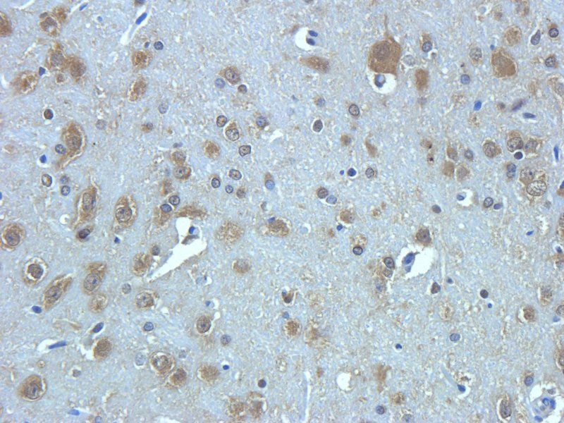TGF beta Receptor 2 Rabbit Polyclonal Antibody