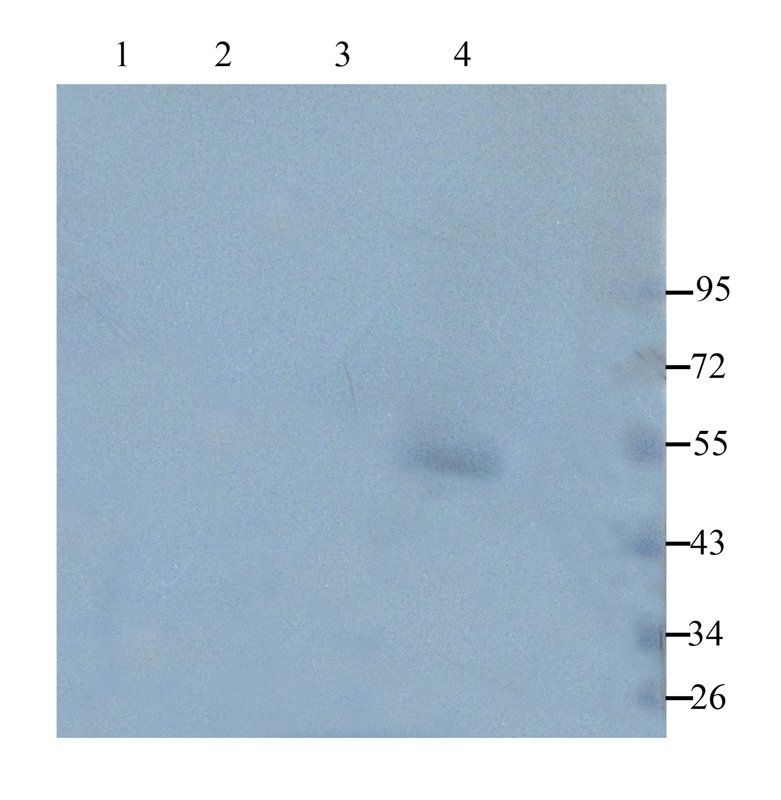 TGF beta Receptor 2 Rabbit Polyclonal Antibody
