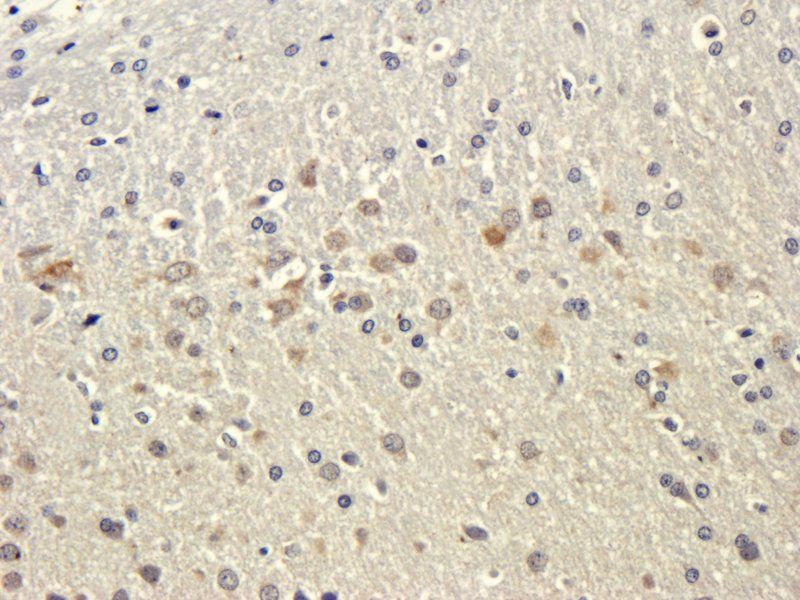 TGF beta Receptor 2 Rabbit Polyclonal Antibody