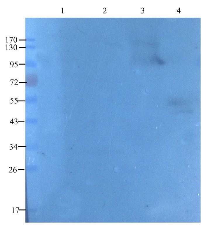 TGF beta Receptor 2 Rabbit Polyclonal Antibody