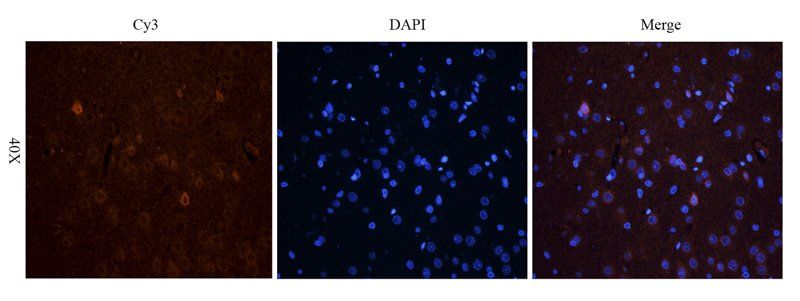 TGF beta Receptor 2 Rabbit Polyclonal Antibody