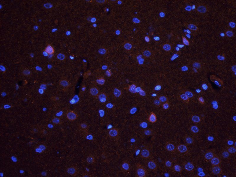 TGF beta Receptor 2 Rabbit Polyclonal Antibody