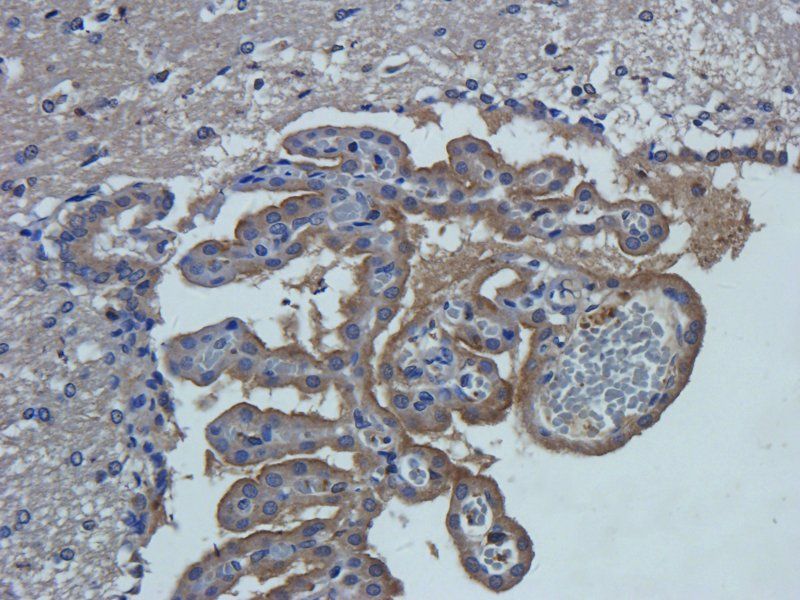 TGF beta Receptor 2 Rabbit Polyclonal Antibody